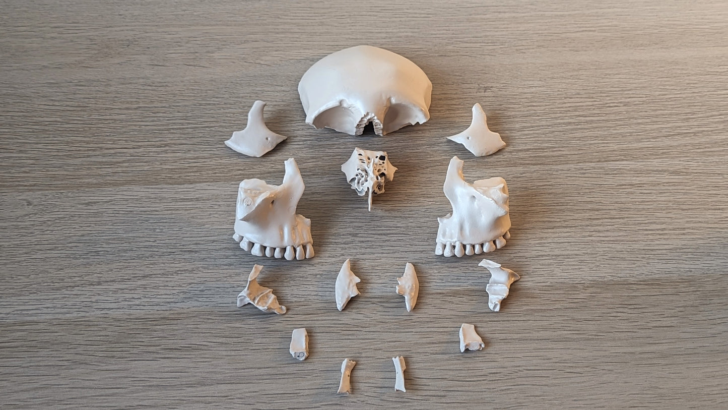 Human Skull 22 pieces
